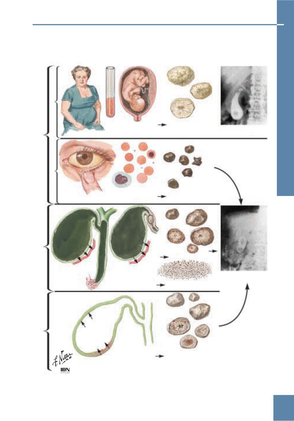 Netter Obstetricia Ginecología Y Salud De La Mujer 5701